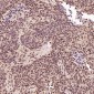 Anti-ACE2 Rabbit Monoclonal Antibody